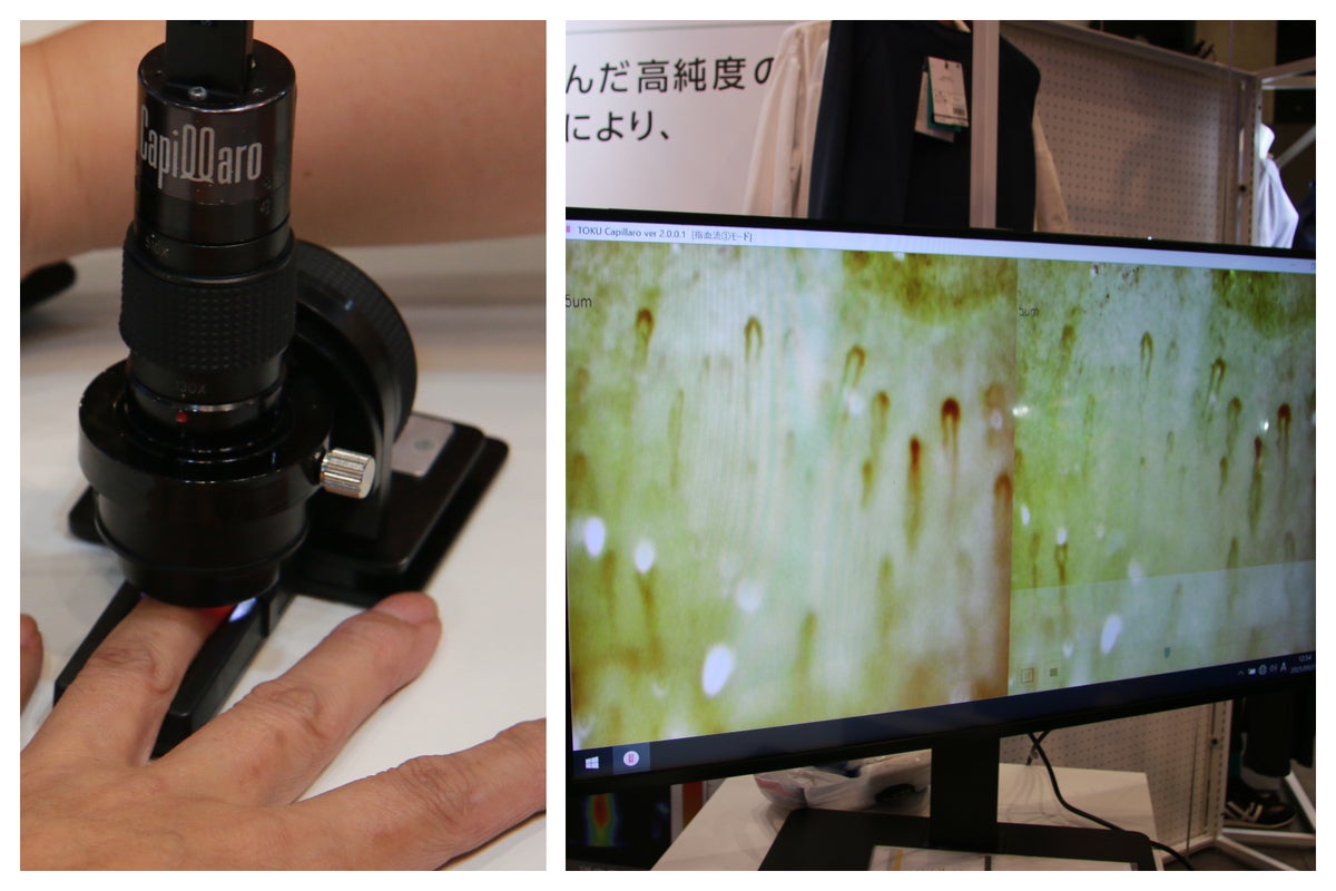 甘皮で血流を観測しているシーン